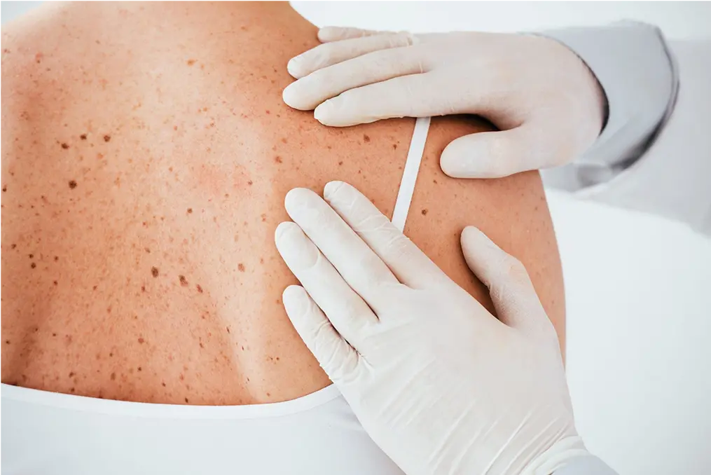 cropped-view-of-dermatologist